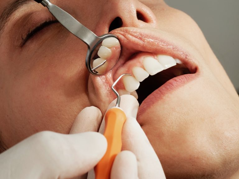 a close-up of a person's mouth