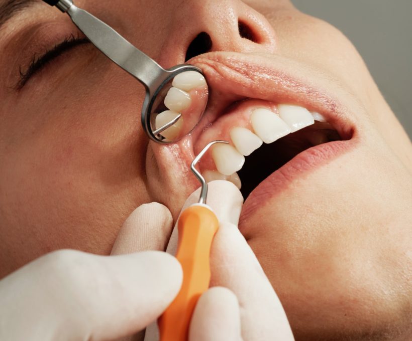 Painless Services To Get Through a Dental Injury